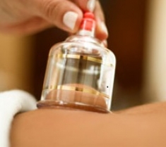 Cupping Massage